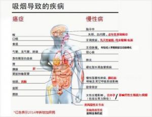  戒烟1-30天，身体会发生哪些惊人变化？