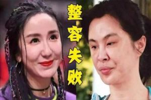 7位女星整形后认不出：以为退圈，没想到是整容了